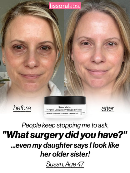 The Peptide Collagen Hydrogel Eye Patch