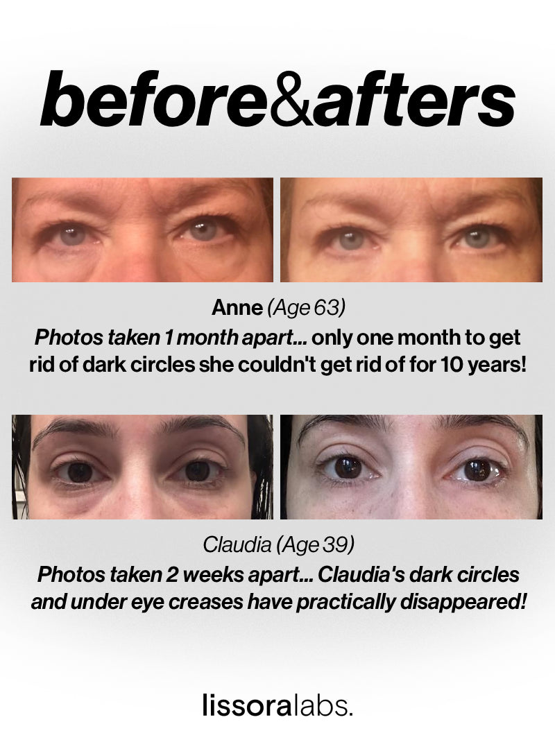 The Peptide Collagen Hydrogel Eye Patch